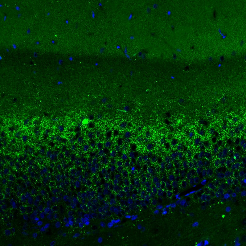 VGLUT2 Antibody (CL2921) - Azide and BSA Free Immunohistochemistry-Paraffin: VGLUT2 Antibody [NBP3-43788]