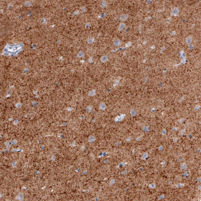 VGLUT2 Antibody (CL2952) - Azide and BSA Free Immunohistochemistry-Paraffin: VGLUT2 Antibody [NBP3-43789]