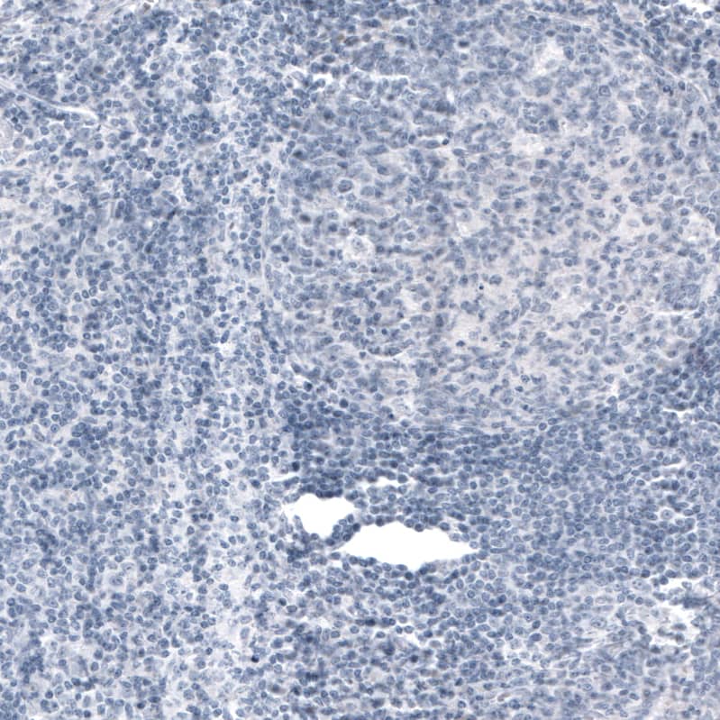 VGLUT2 Antibody (CL2952) - Azide and BSA Free Immunohistochemistry-Paraffin: VGLUT2 Antibody [NBP3-43789]