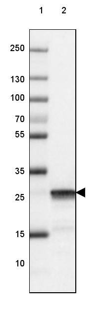 UCH-L1/PGP9.5 Antibody (CL3210) - Azide and BSA Free Western Blot: UCH-L1/PGP9.5 Antibody [NBP3-43791]