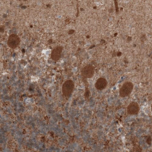 UCH-L1/PGP9.5 Antibody (CL3210) - Azide and BSA Free Immunohistochemistry-Paraffin: UCH-L1/PGP9.5 Antibody [NBP3-43791]