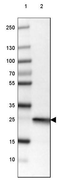 UCH-L1/PGP9.5 Antibody (CL3210) - Azide and BSA Free Western Blot: UCH-L1/PGP9.5 Antibody [NBP3-43791]