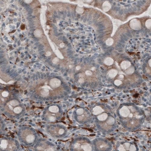 UCH-L1/PGP9.5 Antibody (CL3210) - Azide and BSA Free Immunohistochemistry-Paraffin: UCH-L1/PGP9.5 Antibody [NBP3-43791]
