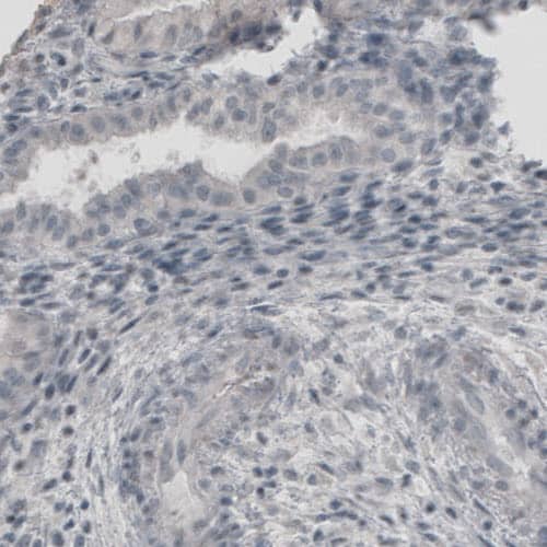 UCH-L1/PGP9.5 Antibody (CL3210) - Azide and BSA Free Immunohistochemistry-Paraffin: UCH-L1/PGP9.5 Antibody [NBP3-43791]