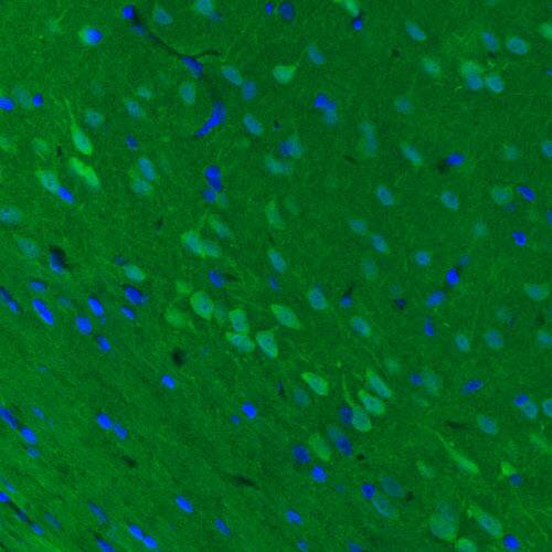 UCH-L1/PGP9.5 Antibody (CL3210) - Azide and BSA Free Immunohistochemistry-Paraffin: UCH-L1/PGP9.5 Antibody [NBP3-43791]