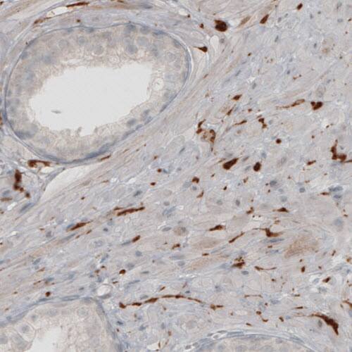 UCH-L1/PGP9.5 Antibody (CL3210) - Azide and BSA Free Immunohistochemistry-Paraffin: UCH-L1/PGP9.5 Antibody [NBP3-43791]