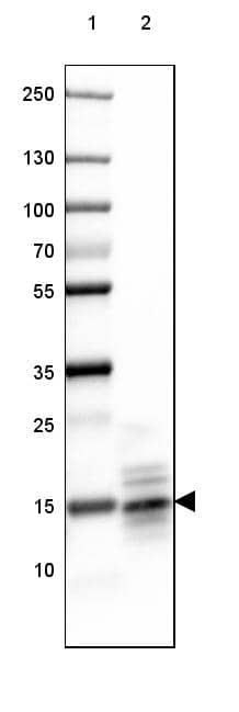 MBP Antibody (CL2827) - Azide and BSA Free Western Blot: MBP Antibody [NBP3-43792]
