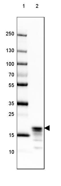 MBP Antibody (CL2829) - Azide and BSA Free Western Blot: MBP Antibody [NBP3-43793]
