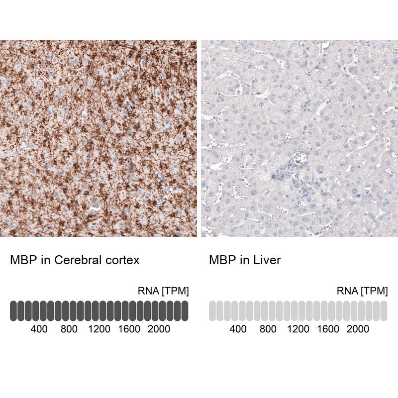 MBP Antibody (CL2829) - Azide and BSA Free Immunohistochemistry-Paraffin: MBP Antibody [NBP3-43793]