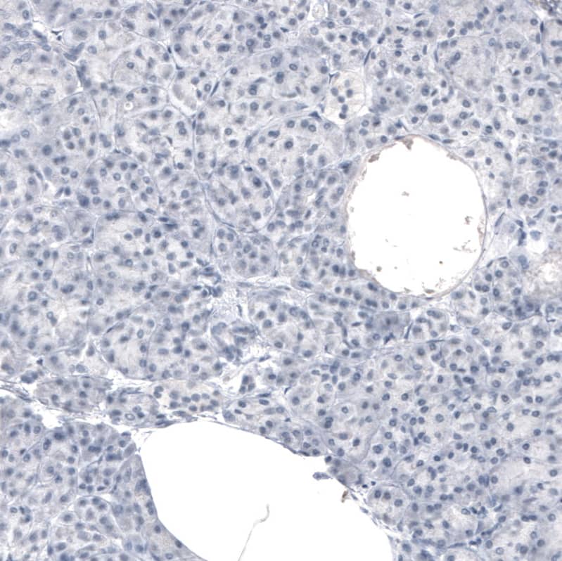 MBP Antibody (CL2829) - Azide and BSA Free Immunohistochemistry-Paraffin: MBP Antibody [NBP3-43793]
