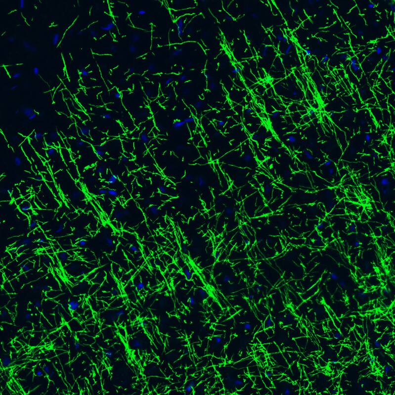 MBP Antibody (CL2829) - Azide and BSA Free Immunohistochemistry-Paraffin: MBP Antibody [NBP3-43793]