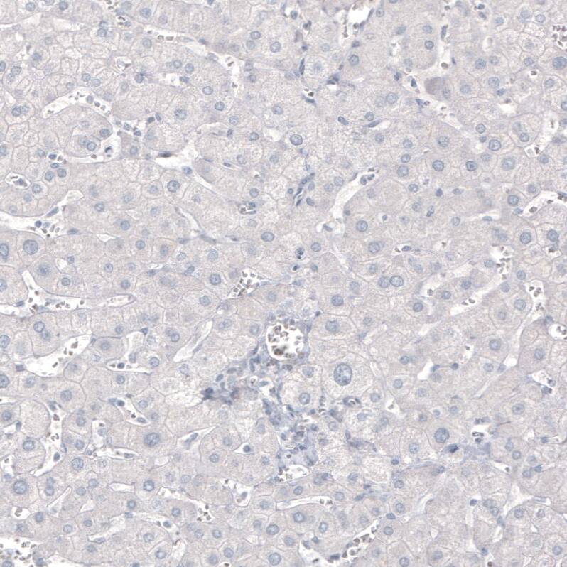 MBP Antibody (CL2829) - Azide and BSA Free Immunohistochemistry-Paraffin: MBP Antibody [NBP3-43793]