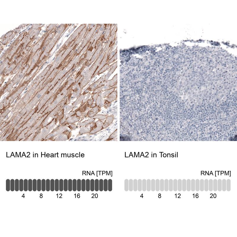 Laminin alpha 2 Antibody (CL3450) - Azide and BSA Free Immunohistochemistry-Paraffin: Laminin alpha 2 Antibody [NBP3-43794]