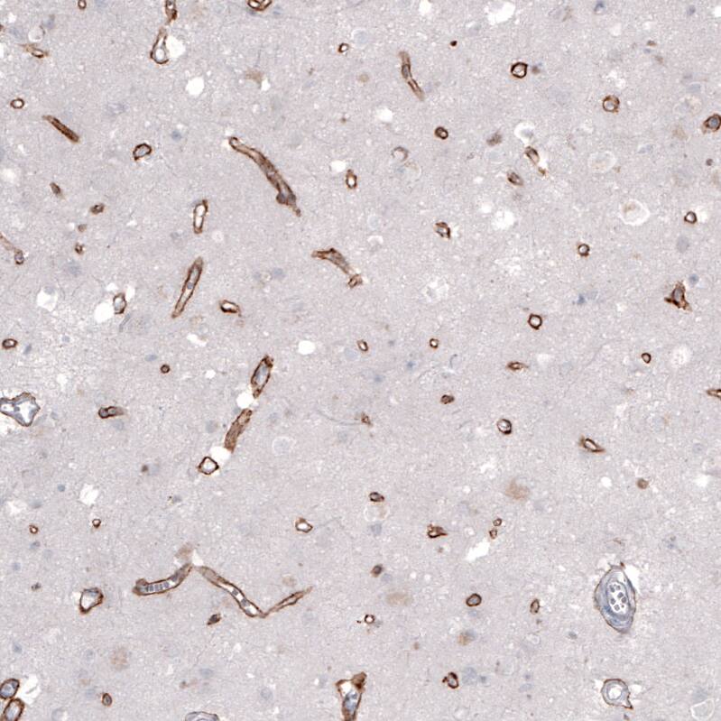 Laminin alpha 2 Antibody (CL3450) - Azide and BSA Free Immunohistochemistry-Paraffin: Laminin alpha 2 Antibody [NBP3-43794]