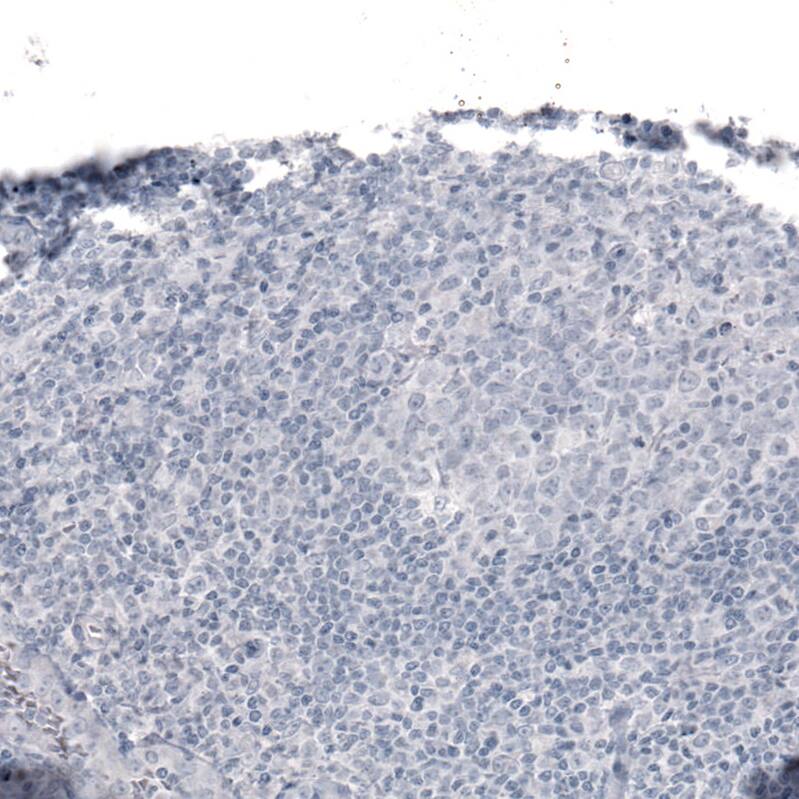 Laminin alpha 2 Antibody (CL3450) - Azide and BSA Free Immunohistochemistry-Paraffin: Laminin alpha 2 Antibody [NBP3-43794]