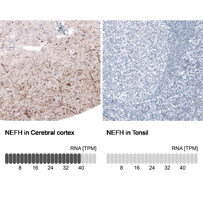 NF-H Antibody (CL2671) - Azide and BSA Free Immunohistochemistry-Paraffin: NF-H Antibody [NBP3-43795]