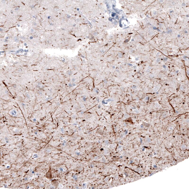 NF-H Antibody (CL2671) - Azide and BSA Free Immunohistochemistry-Paraffin: NF-H Antibody [NBP3-43795]