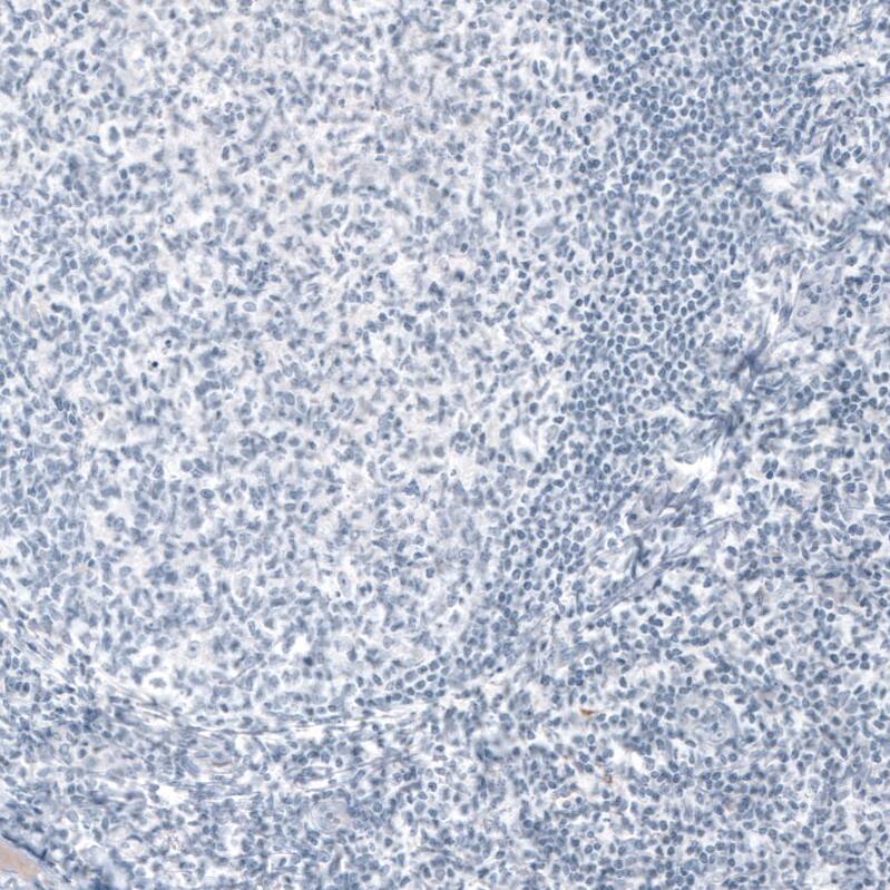 NF-H Antibody (CL2671) - Azide and BSA Free Immunohistochemistry-Paraffin: NF-H Antibody [NBP3-43795]