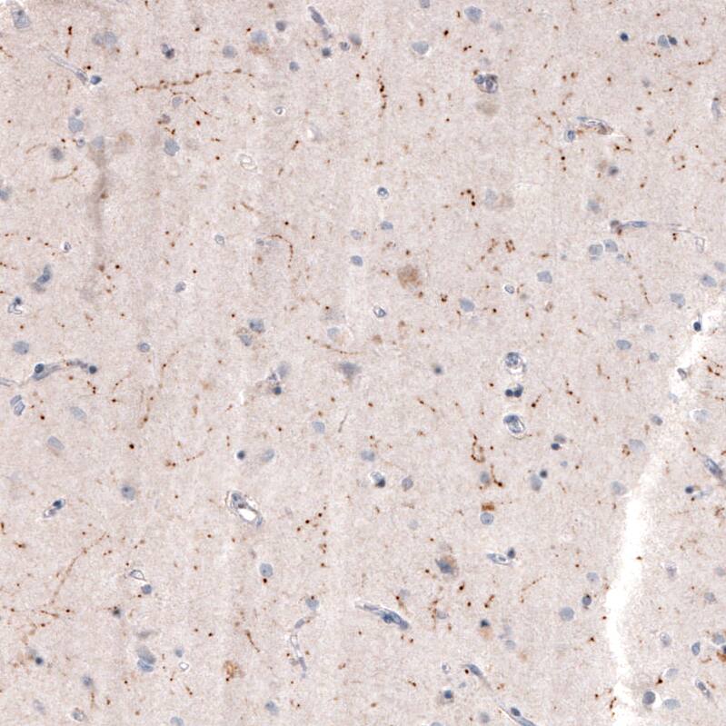 Choline Acetyltransferase/ChAT Antibody (CL3173) - Azide and BSA Free Immunohistochemistry-Paraffin: Choline Acetyltransferase/ChAT Antibody [NBP3-43796]