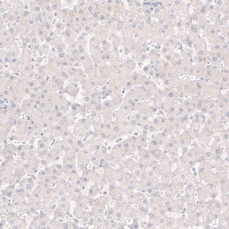 Choline Acetyltransferase/ChAT Antibody (CL3173) - Azide and BSA Free Immunohistochemistry-Paraffin: Choline Acetyltransferase/ChAT Antibody [NBP3-43796]