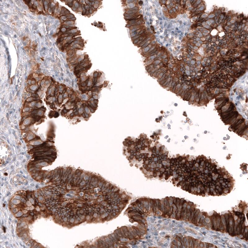 ADAM10 Antibody (CL13809) - Azide and BSA Free Immunohistochemistry-Paraffin: ADAM10 Antibody [NBP3-43797]