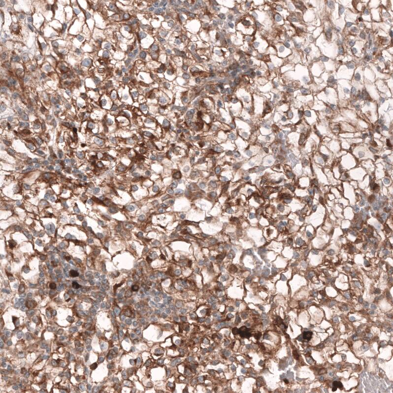 ADAM10 Antibody (CL13809) - Azide and BSA Free Immunohistochemistry-Paraffin: ADAM10 Antibody [NBP3-43797]
