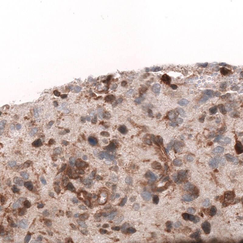 ADAM10 Antibody (CL13809) - Azide and BSA Free Immunohistochemistry-Paraffin: ADAM10 Antibody [NBP3-43797]