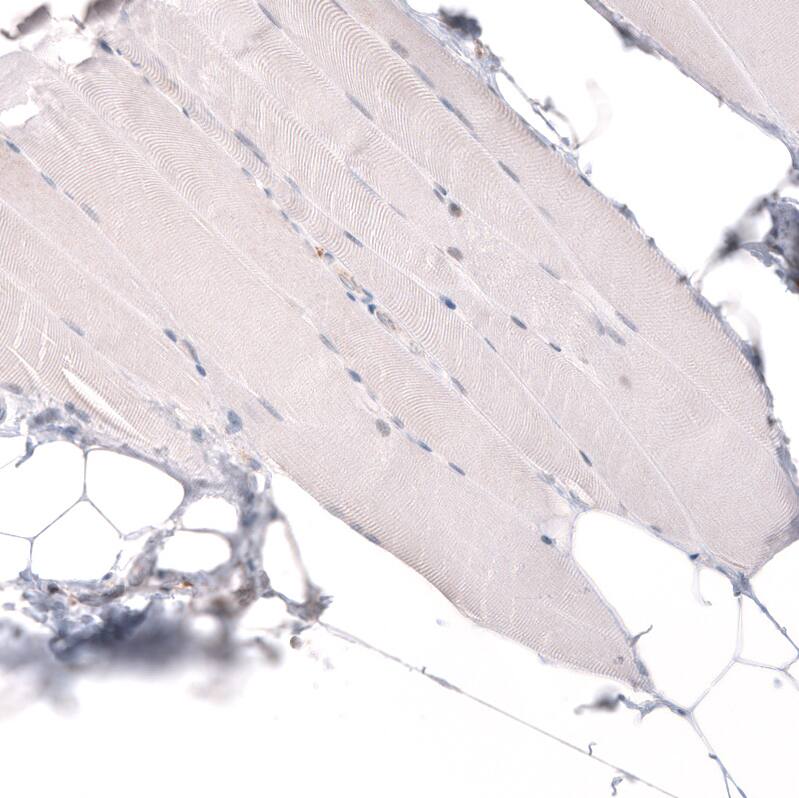 ADAM10 Antibody (CL13809) - Azide and BSA Free Immunohistochemistry-Paraffin: ADAM10 Antibody [NBP3-43797]