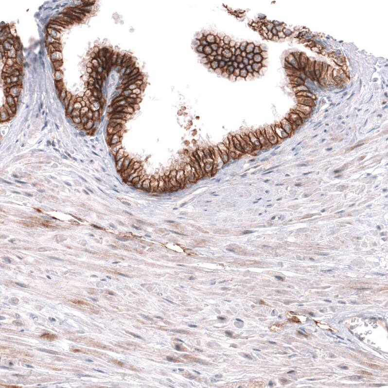 ADAM10 Antibody (CL13809) - Azide and BSA Free Immunohistochemistry-Paraffin: ADAM10 Antibody [NBP3-43797]