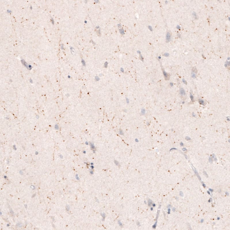 Choline Acetyltransferase/ChAT Antibody (CL3169) - Azide and BSA Free Immunohistochemistry-Paraffin: Choline Acetyltransferase/ChAT Antibody [NBP3-43798]