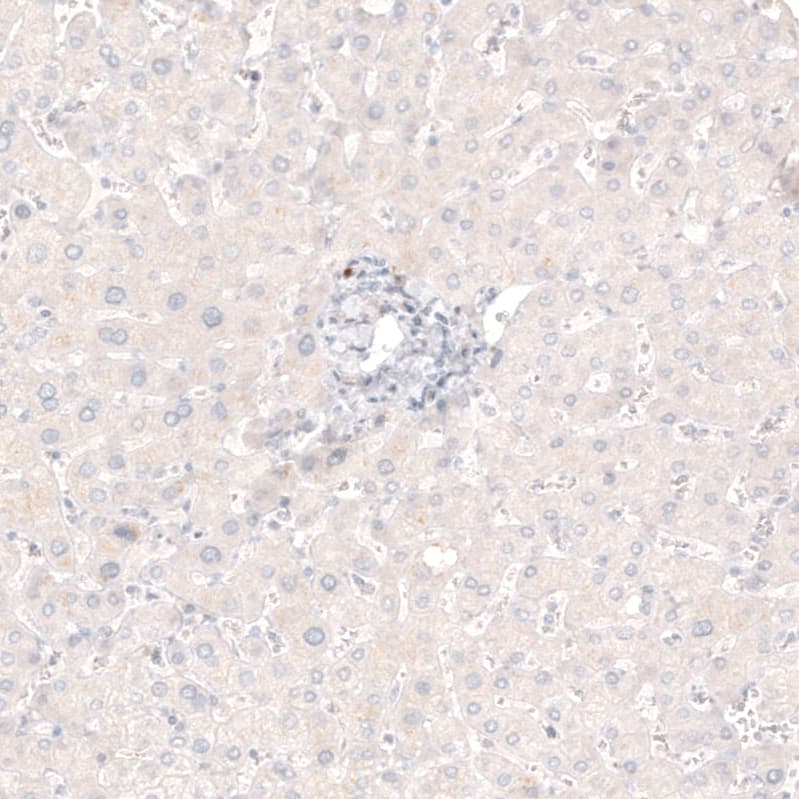 Choline Acetyltransferase/ChAT Antibody (CL3169) - Azide and BSA Free Immunohistochemistry-Paraffin: Choline Acetyltransferase/ChAT Antibody [NBP3-43798]