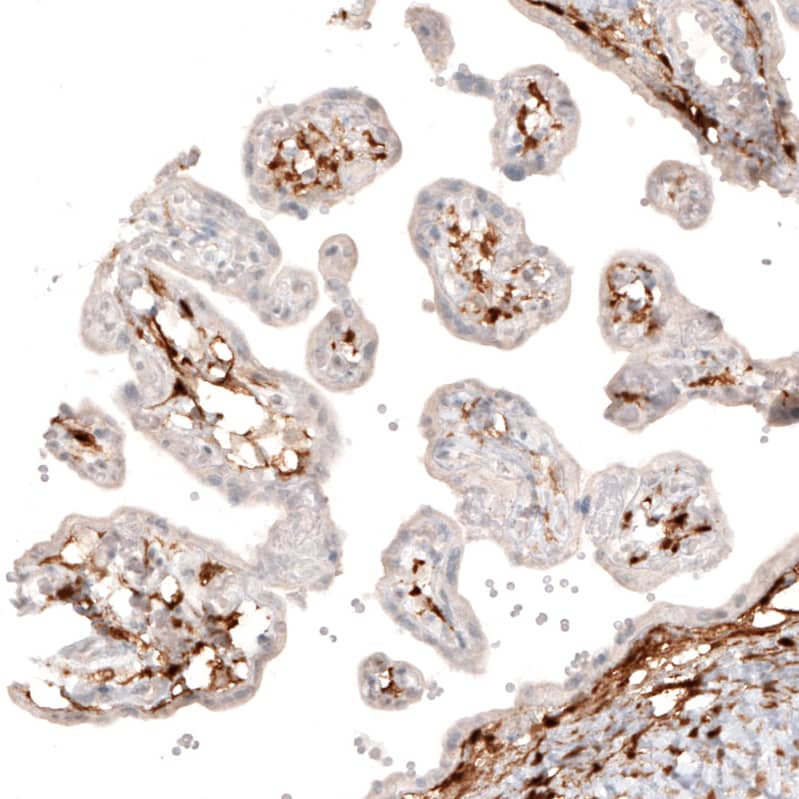 Choline Acetyltransferase/ChAT Antibody (CL3169) - Azide and BSA Free Immunohistochemistry-Paraffin: Choline Acetyltransferase/ChAT Antibody [NBP3-43798]