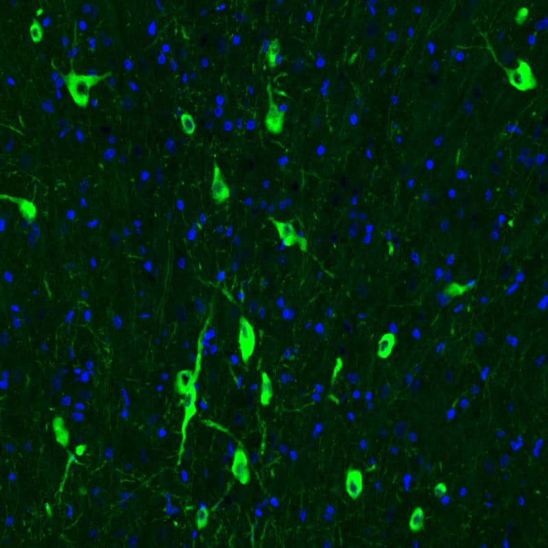 Choline Acetyltransferase/ChAT Antibody (CL3169) - Azide and BSA Free Immunohistochemistry-Paraffin: Choline Acetyltransferase/ChAT Antibody [NBP3-43798]