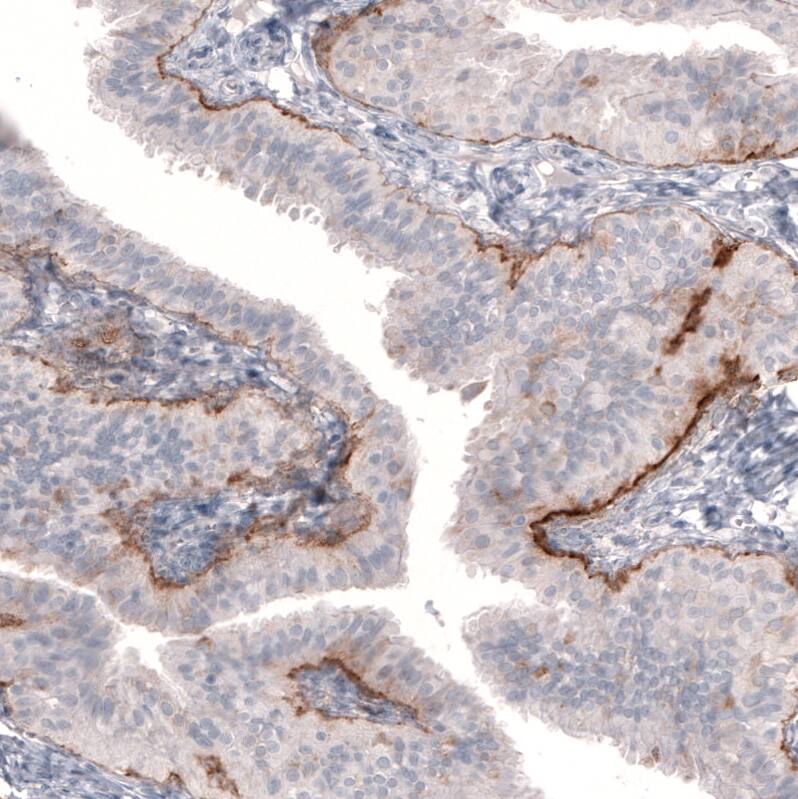 Laminin beta 3 Antibody (CL3353) - Azide and BSA Free Immunohistochemistry-Paraffin: Laminin beta 3 Antibody [NBP3-43799]