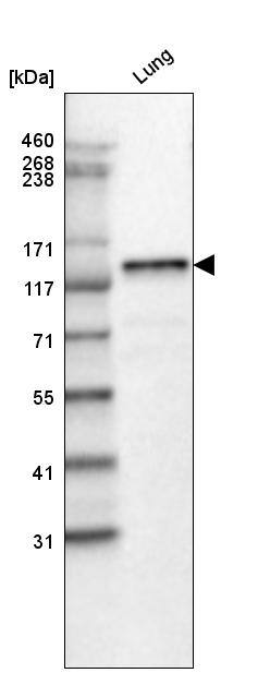 Laminin beta 3 Antibody (CL3353) - Azide and BSA Free Western Blot: Laminin beta 3 Antibody [NBP3-43799]