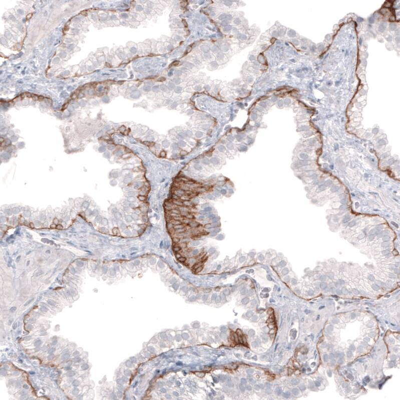Laminin beta 3 Antibody (CL3353) - Azide and BSA Free Immunohistochemistry-Paraffin: Laminin beta 3 Antibody [NBP3-43799]