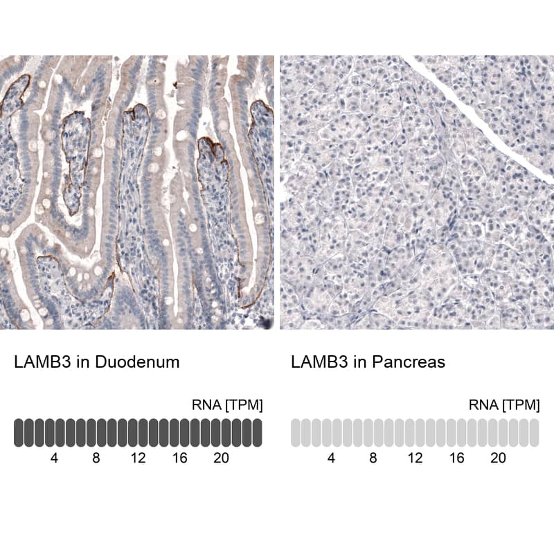 Laminin beta 3 Antibody (CL3363) - Azide and BSA Free Immunohistochemistry-Paraffin: Laminin beta 3 Antibody [NBP3-43800]
