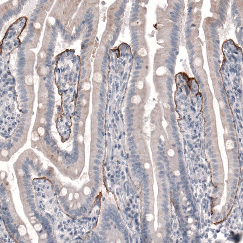 Laminin beta 3 Antibody (CL3363) - Azide and BSA Free Immunohistochemistry-Paraffin: Laminin beta 3 Antibody [NBP3-43800]