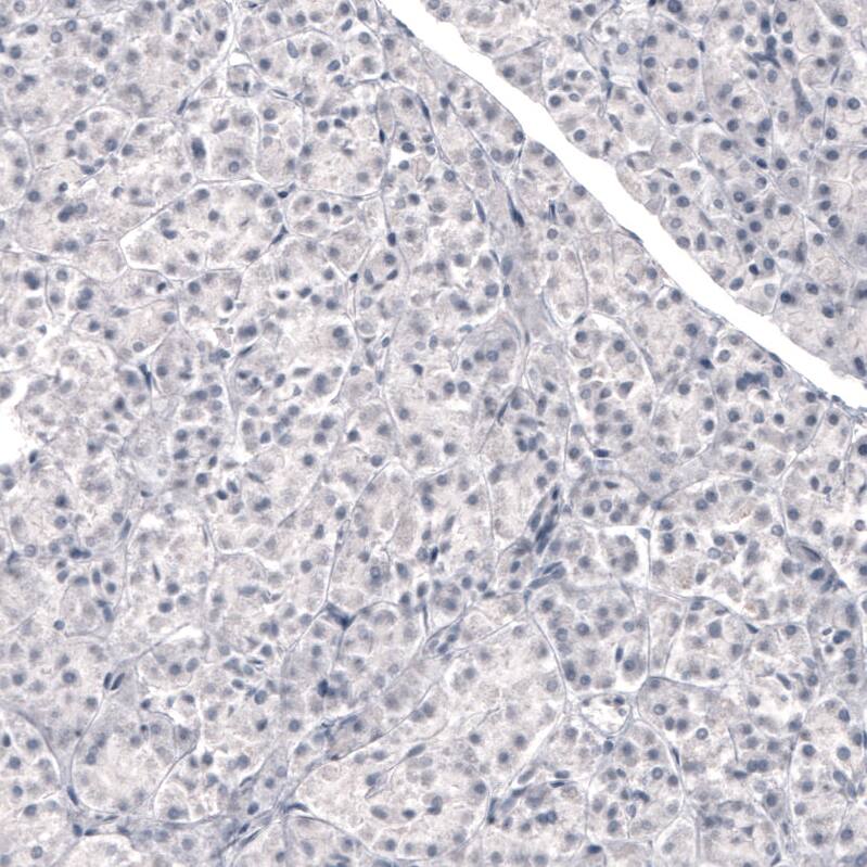 Laminin beta 3 Antibody (CL3363) - Azide and BSA Free Immunohistochemistry-Paraffin: Laminin beta 3 Antibody [NBP3-43800]