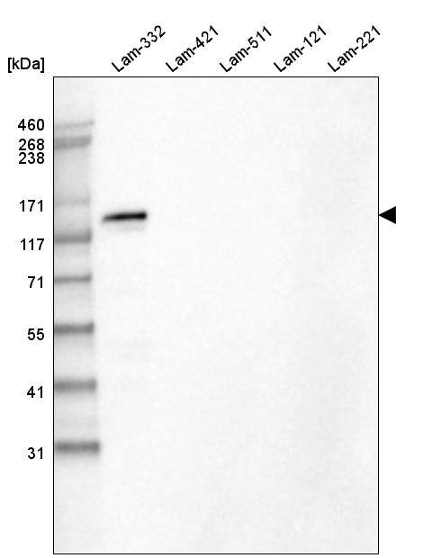 Laminin beta 3 Antibody (CL3363) - Azide and BSA Free Western Blot: Laminin beta 3 Antibody [NBP3-43800]