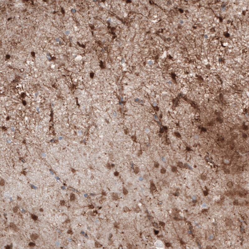S100B Antibody (CL2720) - Azide and BSA Free Immunohistochemistry-Paraffin: S100B Antibody [NBP3-43801]