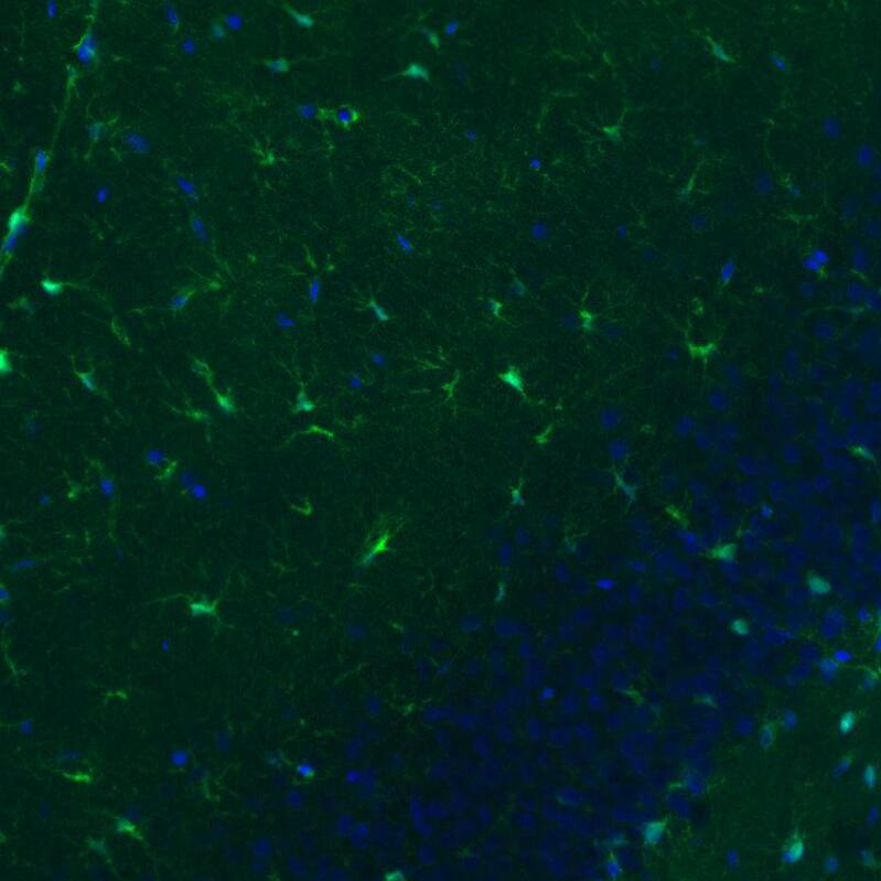 S100B Antibody (CL2720) - Azide and BSA Free Immunohistochemistry-Paraffin: S100B Antibody [NBP3-43801]