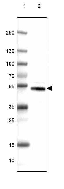 Dopa Decarboxylase/DDC Antibody (CL2962) - Azide and BSA Free Western Blot: Dopa Decarboxylase/DDC Antibody [NBP3-43802]