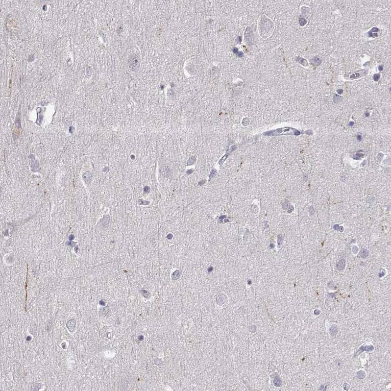 SLC6A3/DAT1 Antibody (CL3123) - Azide and BSA Free Immunohistochemistry-Paraffin: SLC6A3/DAT1 Antibody [NBP3-43803]