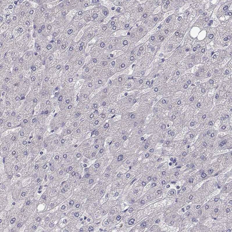 SLC6A3/DAT1 Antibody (CL3123) - Azide and BSA Free Immunohistochemistry-Paraffin: SLC6A3/DAT1 Antibody [NBP3-43803]