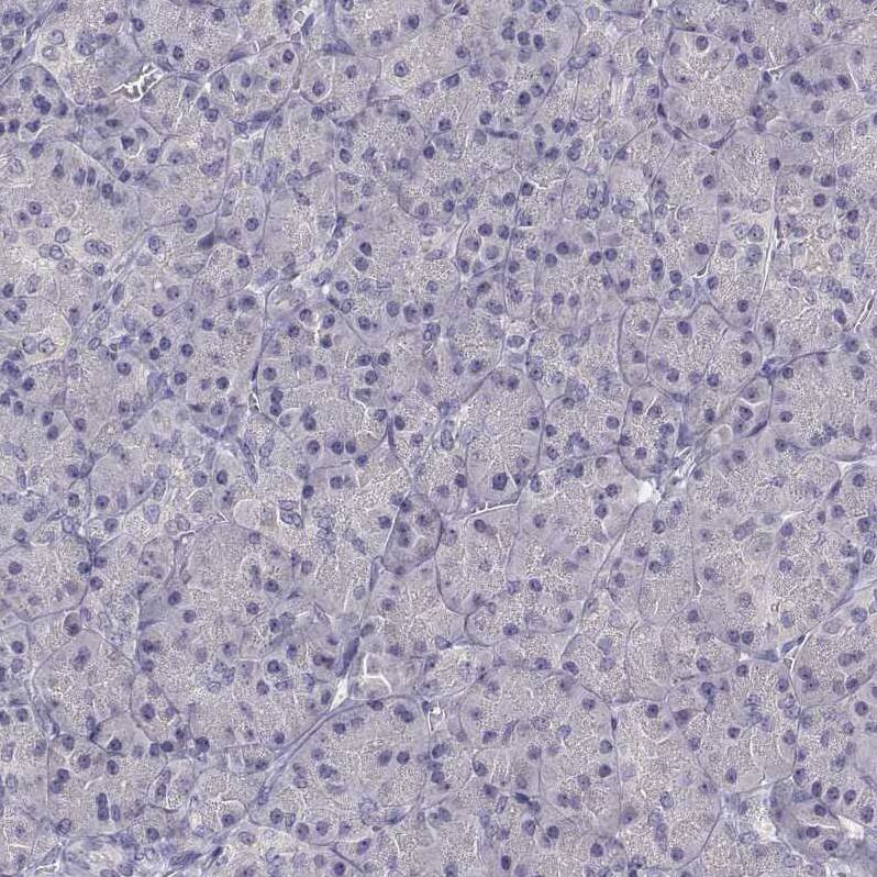 SLC6A3/DAT1 Antibody (CL3123) - Azide and BSA Free Immunohistochemistry-Paraffin: SLC6A3/DAT1 Antibody [NBP3-43803]