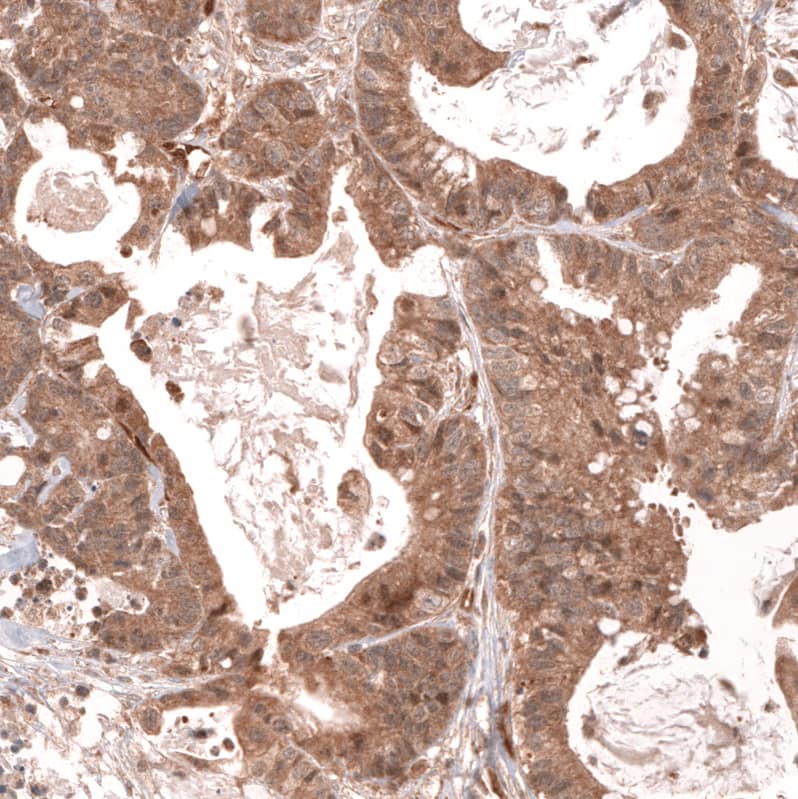 Lgr5/GPR49 Antibody (CL13579) - Azide and BSA Free Immunohistochemistry-Paraffin: Lgr5/GPR49 Antibody [NBP3-43804]