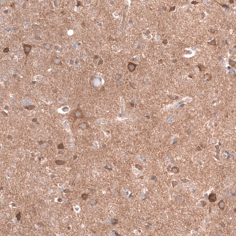 Lgr5/GPR49 Antibody (CL13579) - Azide and BSA Free Immunohistochemistry-Paraffin: Lgr5/GPR49 Antibody [NBP3-43804]