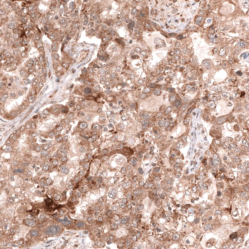 Lgr5/GPR49 Antibody (CL13579) - Azide and BSA Free Immunohistochemistry-Paraffin: Lgr5/GPR49 Antibody [NBP3-43804]