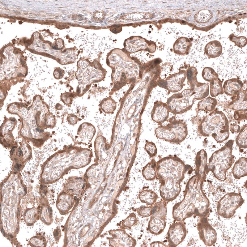 Lgr5/GPR49 Antibody (CL13579) - Azide and BSA Free Immunohistochemistry-Paraffin: Lgr5/GPR49 Antibody [NBP3-43804]